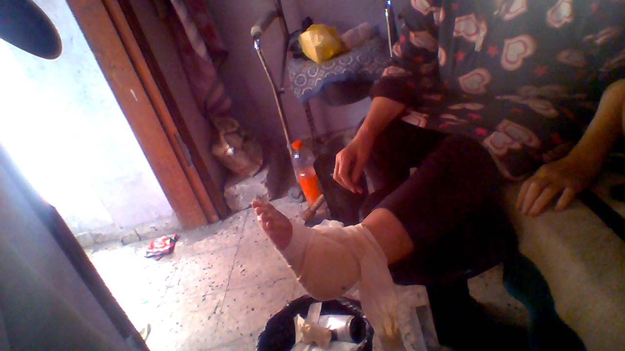 Wound care supplies