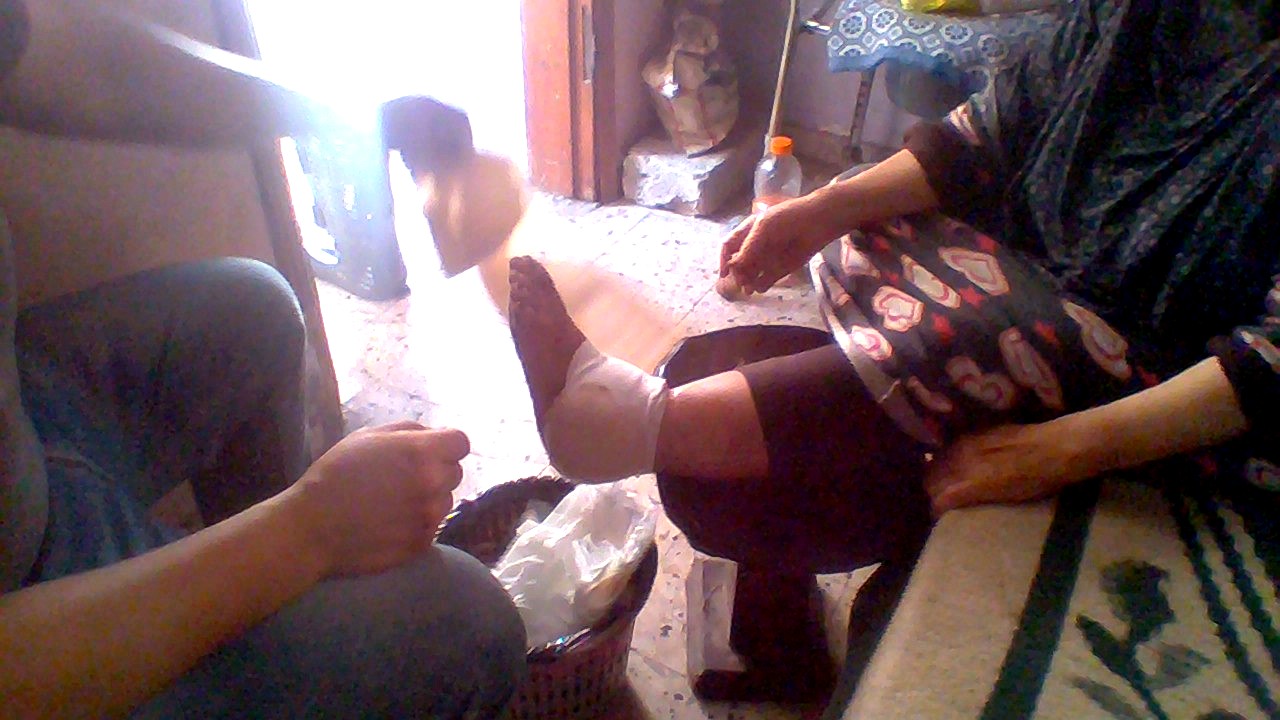 Changing the dressing