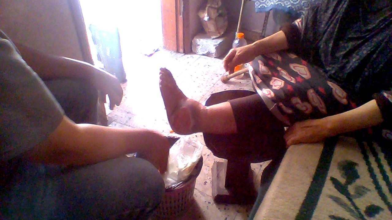 Wound care in progress